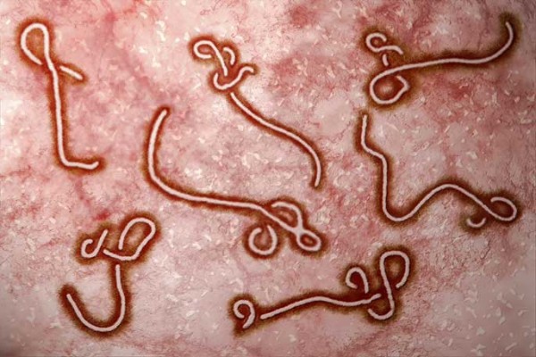 Chip-based Technology Enables Reliable Detection of Ebola Virus