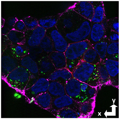 Novel technique spotlights neuronal uptake of amyloid beta in Alzheimer’s disease